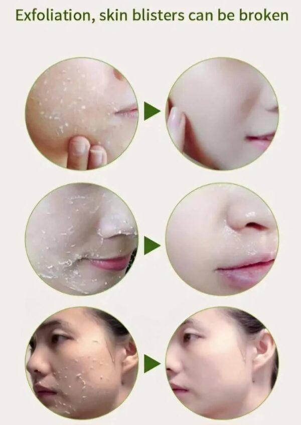 Pomegranated Peeling Gel - Image 3